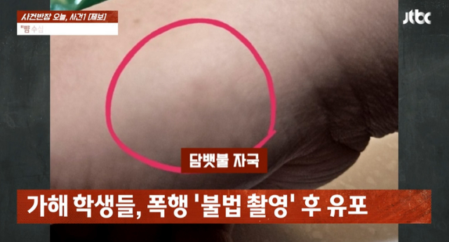 여자 초등학생이 중학생들에게 집단 폭행을 당한 가운데 가해자들이 촉법소년으로 처벌이 불투명해 공분을 사고 있다./JTBC 사건반장