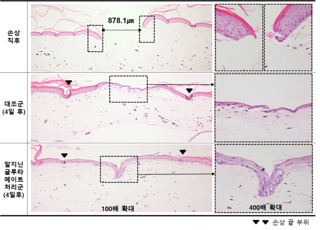 인공 피부 손상 후 피부 재생 효능 평가 결과./LG생활건강