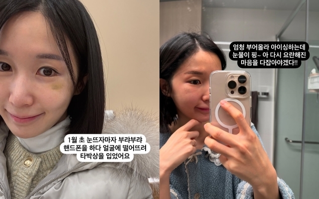 그룹 크레용팝 출신 초아 / 초아 인스타그램