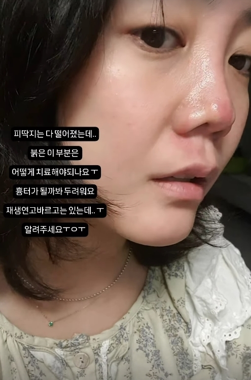 / 고은아 인스타그램