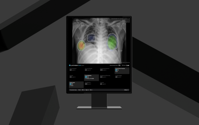 의료 인공지능(AI) 기업 루닛이 신제품 ‘루닛 인사이트 CXR4’로 유럽 CE MDR 인증을 획득했다. /루닛