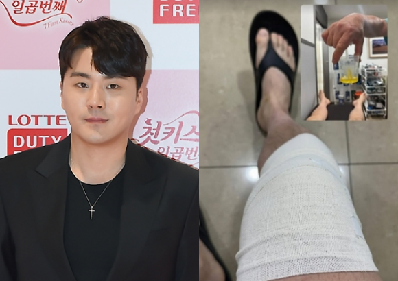 가수 이루/이루 인스타그램